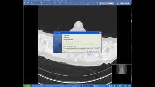 How to save DICOM files from Sectra Ids7 [upl. by Broddy483]