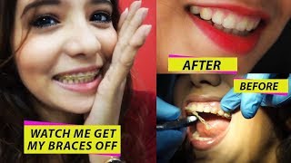 WATCH ME GET MY BRACES OFF amp THE DRASTIC CHANGE IN MY TEETH [upl. by Altaf]