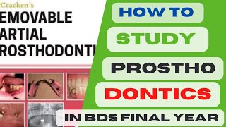 How to Study Prosthodontics in BDS final YearImportant topics of prosthodonticspast papers prostho [upl. by Artapoelc749]