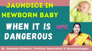 Jaundice In New Born Babies  Symptoms amp Treatment  Dr Swapna Chekuri  HFC [upl. by Meave294]