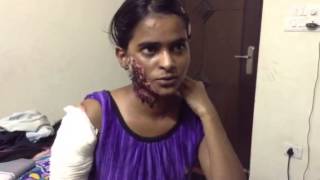 Acid Attack Fighter Laxmi interviewing Sapna [upl. by Ilanos530]