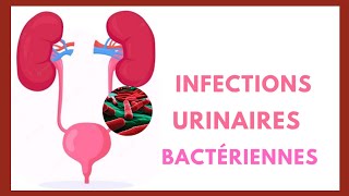 Les Infections Urinaires Bactériennes [upl. by Reuben]