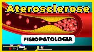 Aterosclerose Patogenia Fisiopatologia e tipos  Resumo Patologia 2024 [upl. by Ailemor]