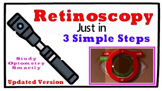 Updated Retinoscopy just in 3 Simple Steps [upl. by Llib]