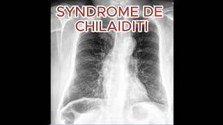 SYNDROME DE CHILAIDITI radiologystudent anatomy femmemedecine science doctor [upl. by Arikehs]