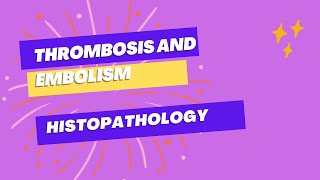 Thrombosis and Embolism Pathology  Ample Medical Lectures [upl. by Oiuqise]