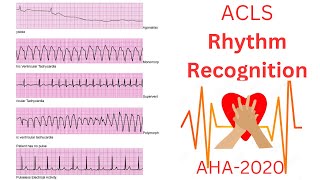 ACLS Rythem Recognitions 2023 Easy guide [upl. by Anaoj]