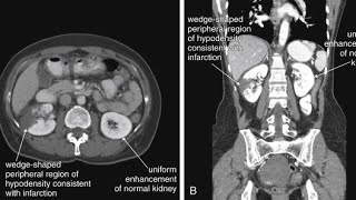 Imaging of Genitourinary System  Part 1  Radiology [upl. by Sivatco419]