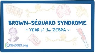 BrownSéquard syndrome Year of the Zebra [upl. by Sammy]