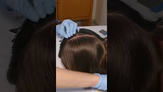 ASMR Scalp Check amp Hairline Exam with Sensory Tests Real Person asmr shorts short [upl. by Nabroc]