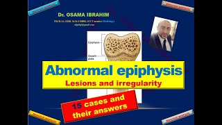 Abnormal epiphysis 15 cases with their answers [upl. by Mobley]