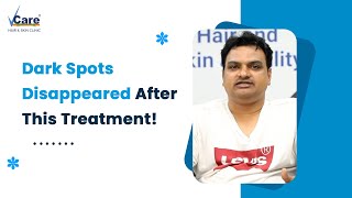 This Treatment Transformed His Skin Completely [upl. by Ailefo663]