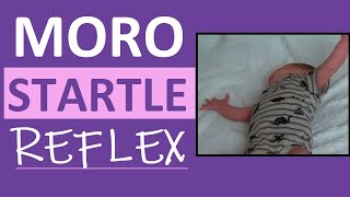 Moro Reflex Newborn Test  Startle Reflex  Pediatric Nursing Assessment [upl. by Irme]