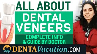 Complete Guide to Dental Veneers [upl. by Kane]