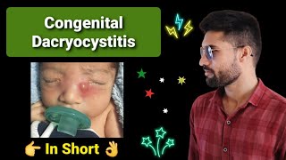 Congenital Dacryocystitis Lecture opthalmology [upl. by Aynotan]