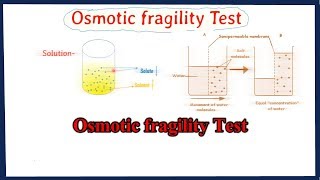 osmotic fragility test  osmotic fragility curve interpretation  full explained [upl. by Mortimer]