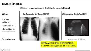 Derrames Pleurales Dra Ana Inés Gruss  Módulo Respiratorio [upl. by Tina167]