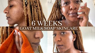 Goat Milk Soap For My Hyperpigmentation Textured and Oily Skin  Clear Skin umoyonh [upl. by Ramiah]