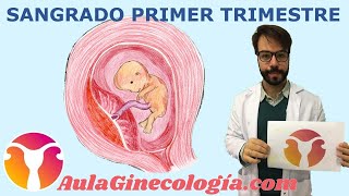 SANGRADO PRIMER TRIMESTRE Diagnóstico diferencial causas ecografía  Ginecología y Obstetricia [upl. by Allimak398]