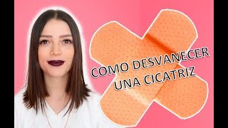 ¿Cómo desvanecer una cicatriz Cicatricure funciona  Story Time  Lylocyv [upl. by Emyaj]