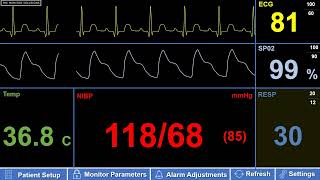 Simulated Adult Patient Monitor – Tachypnea Fast Respiratory Rate [upl. by Elgna460]