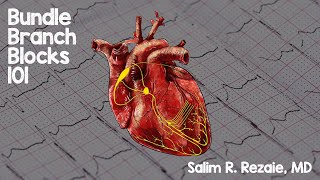 Bundle Branch Blocks 101 [upl. by Micheline795]