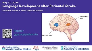 Language Development after Perinatal Stroke [upl. by Asenaj]