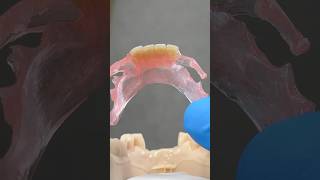 TCS FiberFlex Partial tcsdentalinc tcsdentalinc dental teeth smile lsk121shorts shortvideo [upl. by Marty]