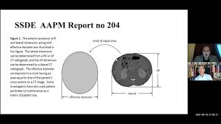 SCMPCR ELP04 Lecture7 CT Dosimetry and Reconstruction Algorithms [upl. by Octavius831]