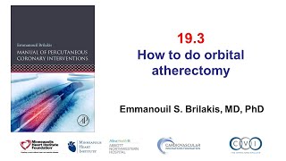 193 Orbital atherectomy Manual of PCI [upl. by Laird]