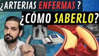 INTERESANTE¡ Exámenes para saber SI TENGO las ARTERIAS del corazón ENFERMAS 😲 [upl. by Yelmene]