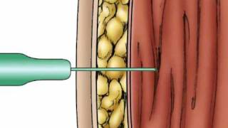 Pharmacology IM Absorption [upl. by Sorcim206]