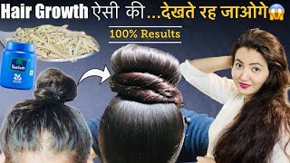 14 Days Hair Growth Transformation  Regrow Lost Hair Get Double Density amp Thick Long Hair❤️ [upl. by Josi]