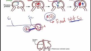 USMLE ACE Video 112 Embryonic development of atrial septum and ventricular septum [upl. by Kahl402]