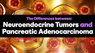 Difference Between Neuroendocrine and Adenocarcinoma Pancreatic Cancers [upl. by Laehpar]