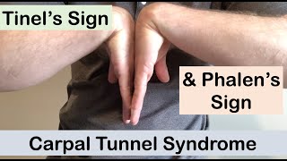 Carpal tunnel syndrome  Tinel’s sign and Phalen’s sign  Clinical Examination [upl. by Cuttler]