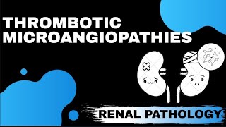 THROMBOTIC MICROANGIOPATHIES  Renal Pathology   Med Bees [upl. by Cassondra]