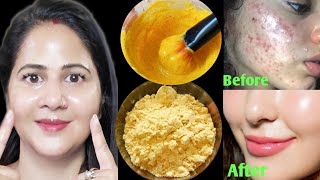 सिर्फ 3 Days मैंSmooth Tight Glass SkinNo Pores No रिंकल्स पाएं हीरे जैसी चमक👌 [upl. by Norita]