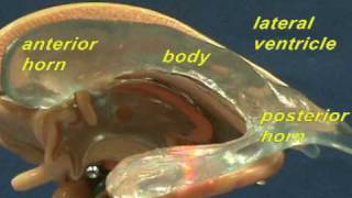 Brain Stem Model  Lateral amp Third Ventricles [upl. by Cyndi]