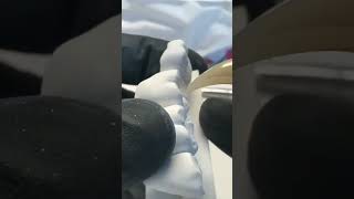 Occlusal plane viralvideo dentistryworld dentaltreatment satisfying orthodontist dentistry [upl. by Pizor284]