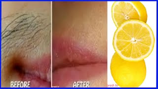 Unwanted hair removal for women naturally with lemon remedy  face hair removal for women at home [upl. by Nede]