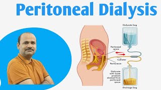 Peritoneal Dialysis  Peritoneal dialysis Class 12 biology  by Dr Bhojoo Mal [upl. by Wivinia801]