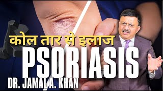 Psoriasis Causes Triggers and Treatments  Dr Jamal A Khan [upl. by Lepley]