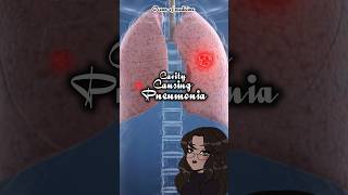 CavityCausing Pneumonia causativeorganisms shorts medicalshorts [upl. by Ynohta610]