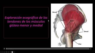 Evaluacion ecografica de los tendones de los musculos gluteo menor y gluteo medial [upl. by Anwad352]