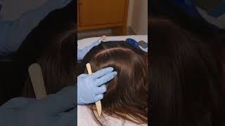 ASMR Scalp Check amp Hairline Exam with Sensory Tests Real Person asmr shorts short [upl. by Olson]