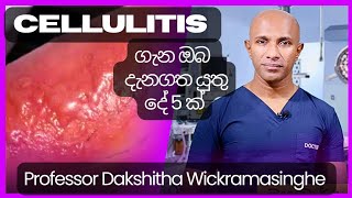 Cellulitis සෙලියුලයිටිස් ගැන ඔබ දැනගතයුතු දේ 5ක්  මහාචාර්ය දක්ෂිත වික්‍රමසිංහ [upl. by Ahsyek]