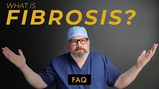 What Can You Do To Prevent FIBROSIS After Liposuction [upl. by Rosinski617]