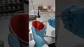 Catalase Test Procedure catalase lab pathology [upl. by Ley]