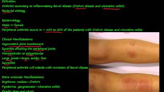 100P  Enteropathic Arthropathy [upl. by Malissa]